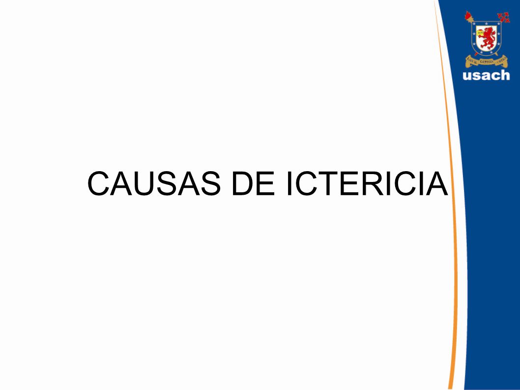 Causas prehepáticas (hígado) de ictericia Causas prehepáticas (hígado) de ictericia